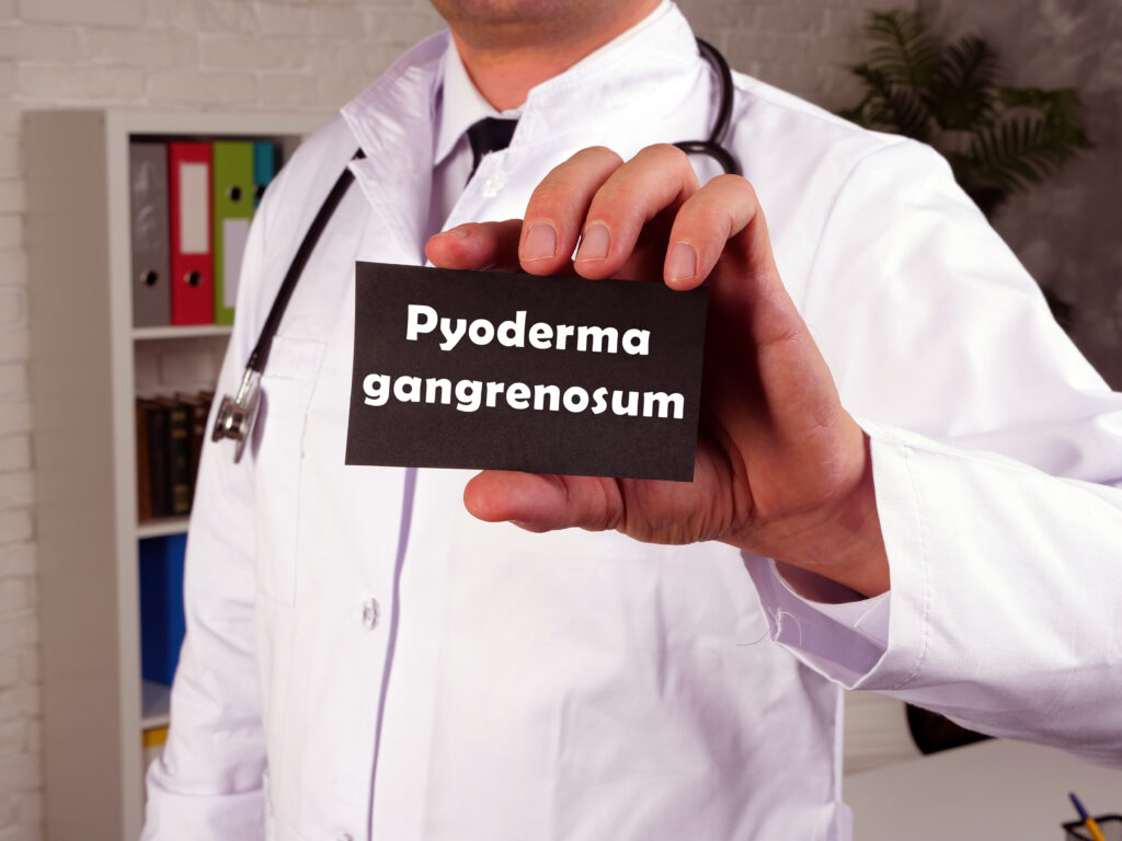 Health care concept meaning Pyoderma gangrenosum with sign on the sheet.